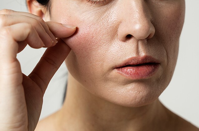 1782454340-4c37070774-13-1-4902-3808-5493-width638height422 Sự suy giảm collagen là một trong những nguyên nhân chính khiến làn da lão hóa, mất độ săn chắc và xuất hiện nếp nhăn. Ảnh: kosmoderma
