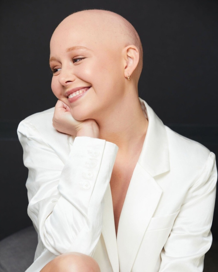 1782555974-2763fc5ef8-156-48818-17-5399-7201-9304-width740height925 McKeon từng rụng tóc trong quá trình điều trị ung thư. Ảnh: IG