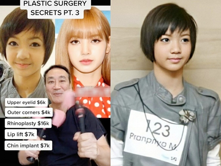 1783297868-359164a0f1-lisa_4-width740height556 Bí ẩn nhan sắc Lisa của BLACKPINK: Đỉnh cao nghệ thuật trang điểm hay phẫu thuật? - 4