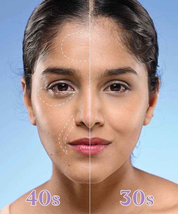 1784186508-859f275022-best-anti-aging-serum-for-40s-6159-7403-9274-width740height888 Sự suy giảm collagen, elastin cùng những thay đổi nội tiết khiến làn da ở tuổi 40 dễ chảy xệ, nhăn và mất độ căng mịn hơn so với tuổi 30. Ảnh: Vilvah Sote