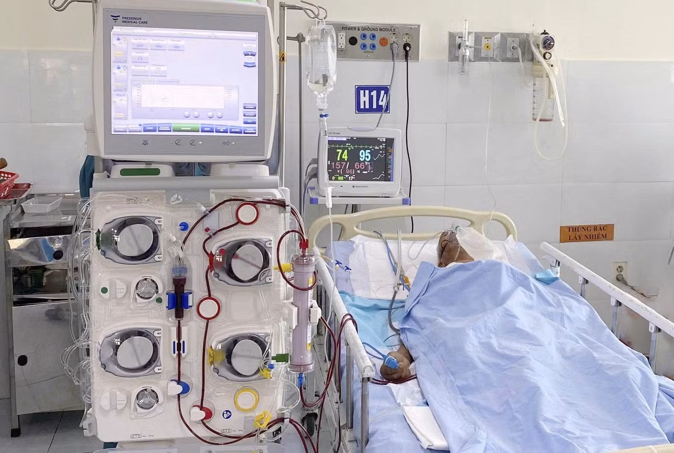 Cụ ông 98 tuổi bị ong vò vẽ đốt 80 nốt được thực hiện lọc máu liên tục, qua cơn nguy kịch. Ảnh B. H