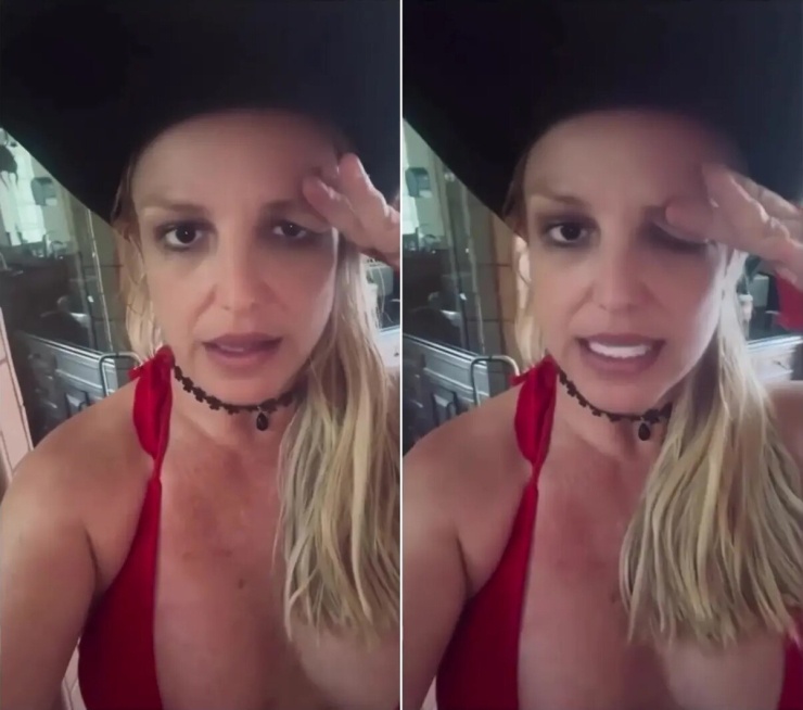 1786328104-d67a5ee0d1-britney-7935-7926-8594-width740height654 Britney minh họa mí mắt bị sụp do tiêm botox.