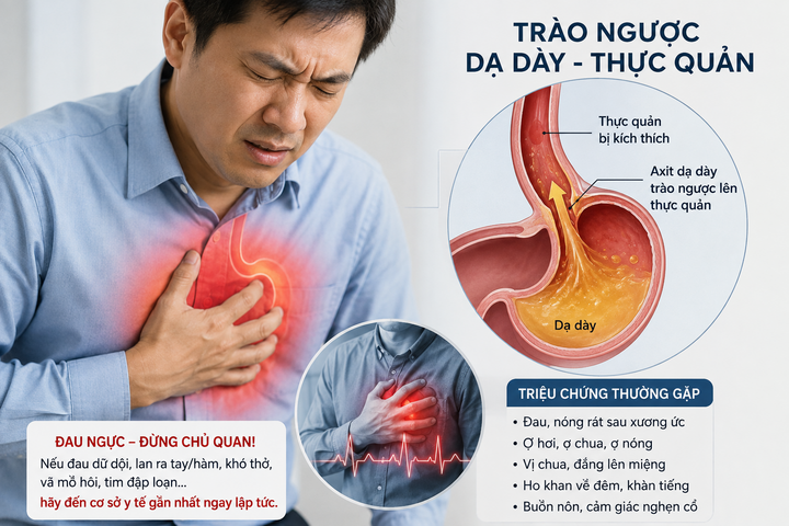 1786524256-d9922b3d59-trao-nguoc-da-day-65-width720height480 Đau ngực tưởng mắc bệnh tim, bác sĩ phát hiện ‘thủ phạm’ từ dạ dày. (Ảnh minh họa)