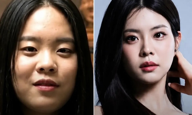 Hình cũ và gần đây của Woo Seo Yoon gây bàn tán trên các diễn đàn sắc đẹp. Ảnh: Instagram/Rocket Mag
