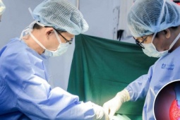 adt1777249408-23aad717c8-ung-thu-tuyen-giap-di-can__anh_cat_3_2 Chia sẻ của người đàn ông 42 tuổi phát hiện mắc ung thư tuyến giáp di căn: Không có triệu chứng