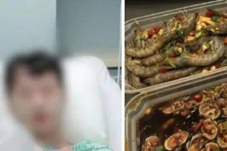 Người đàn ông suýt chết sau bữa hải sản sống