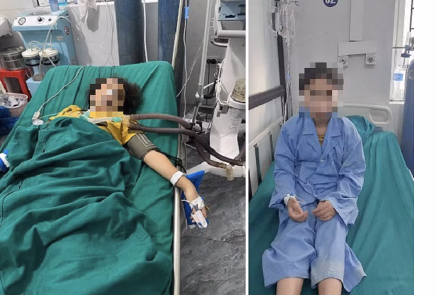 Cháu bé 12 tuổi được cấp cứu trong tình trạng nguy kịch (bên trái) và đang hồi phục sức khỏe (bên phải).