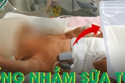 Nhầm sữa mẹ với sữa tươi, trẻ sinh non 31 tuần mắc viêm ruột hoại tử