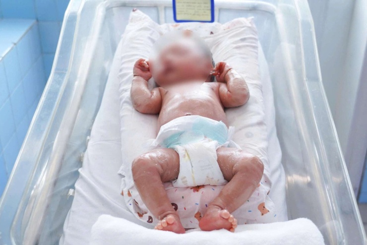 Bé sơ sinh mắc bệnh vảy cá dạng phiến (Lamellar Ichthyosis) hiếm gặp. Ảnh: BVCC