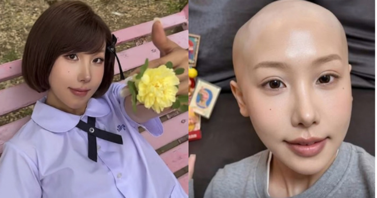 Xu Ziting qua đời vì ung thư dạ dày ở tuổi 25. Ảnh: Douyin