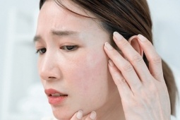 adt1764035431-womanworriedaboutfacedermato-1-1791-__anh_cat_3_2 Thói quen khiến da khô nẻ dù thoa kem dưỡng ẩm thường xuyên