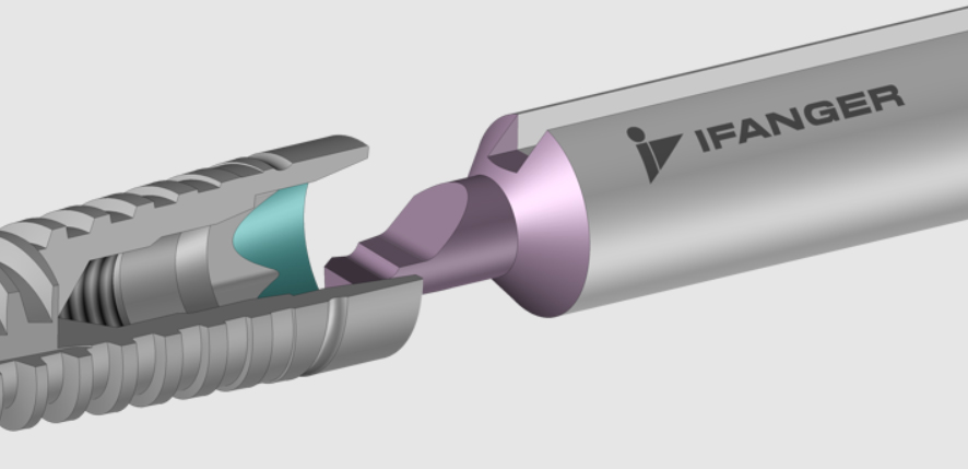Ifanger Implant
