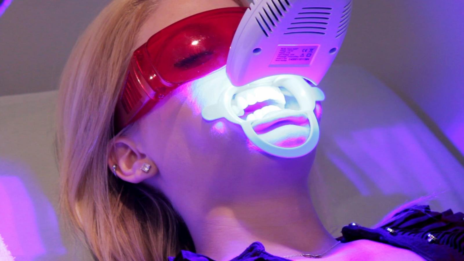 Công nghệ tẩy trắng răng Laser Best White không gây hại men răng 