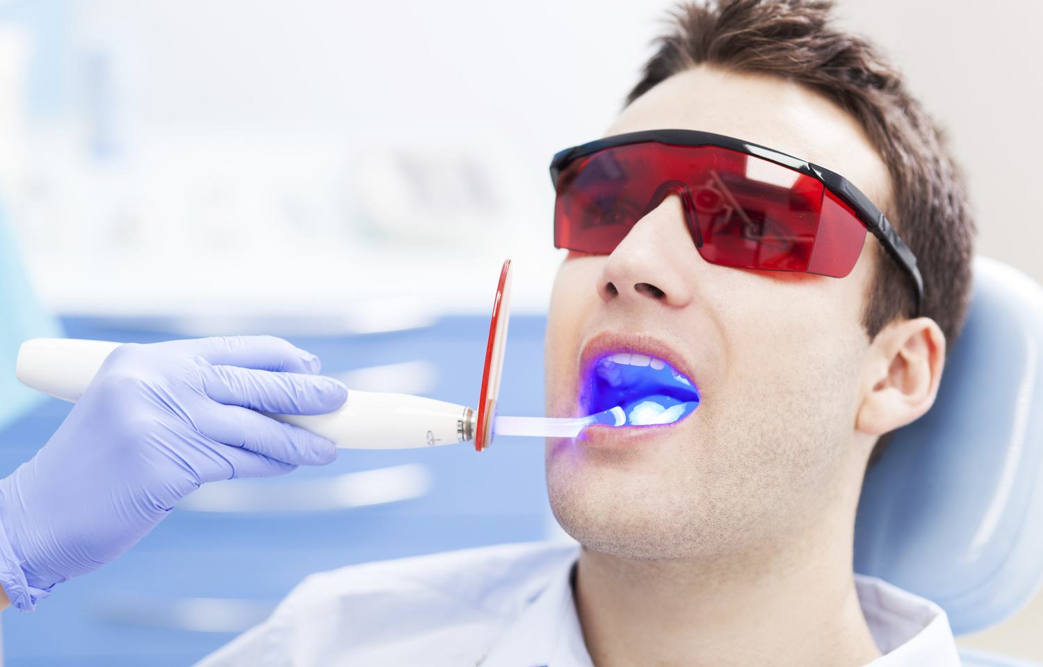 Tẩy trắng răng với công nghệ hiện đại, an toàn cho sức khỏe