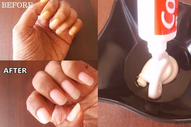 cách làm móng tay nhanh dài và đẹp bằng kem đánh răng - Baotrithuc.vn