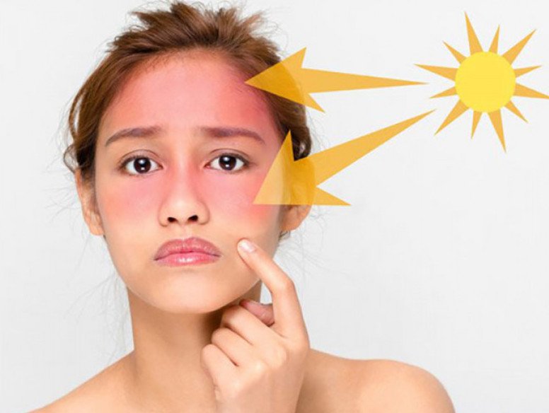 Chăm sóc da mặt với sản phẩm dành cho da nhạy cảm