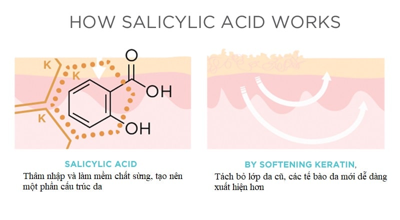 Salicylic acid rât quan trọng với da