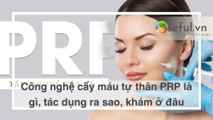 Cong nghệ cấy máu tự thân PRP