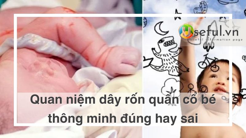 Quan niệm dây rốn quấn quanh cổ