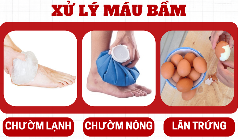 Móng chân bị đen nguyên nhân và cách điều trị hiệu quả 