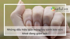 Những dấu hiệu qua móng tay cảnh báo sức khoẻ đang giảm sút