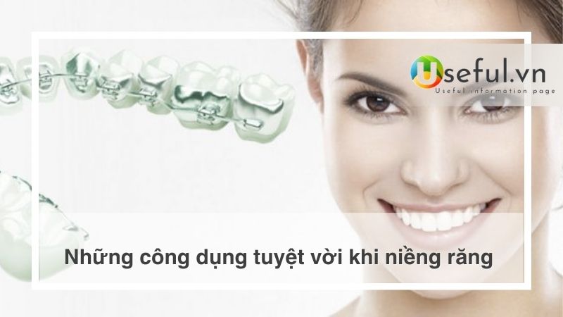 Những công dụng tuyệt vời khi niềng răng