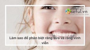 Làm sao để phân biệt răng sữa và răng vĩnh viễn