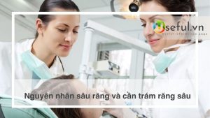 Nguyên nhân sâu răng và cần trám răng sâu