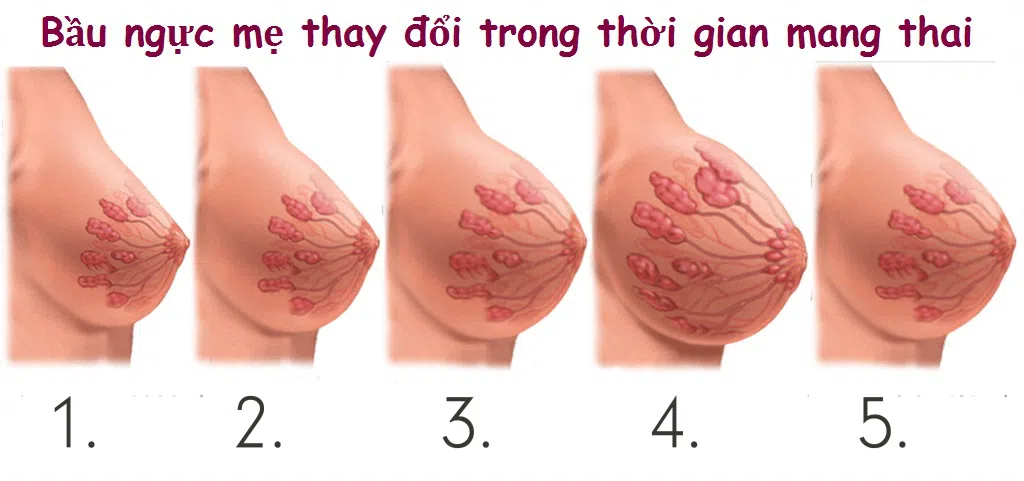 Sự thay đổi bầu ngực của phụ nữ khi mang thai