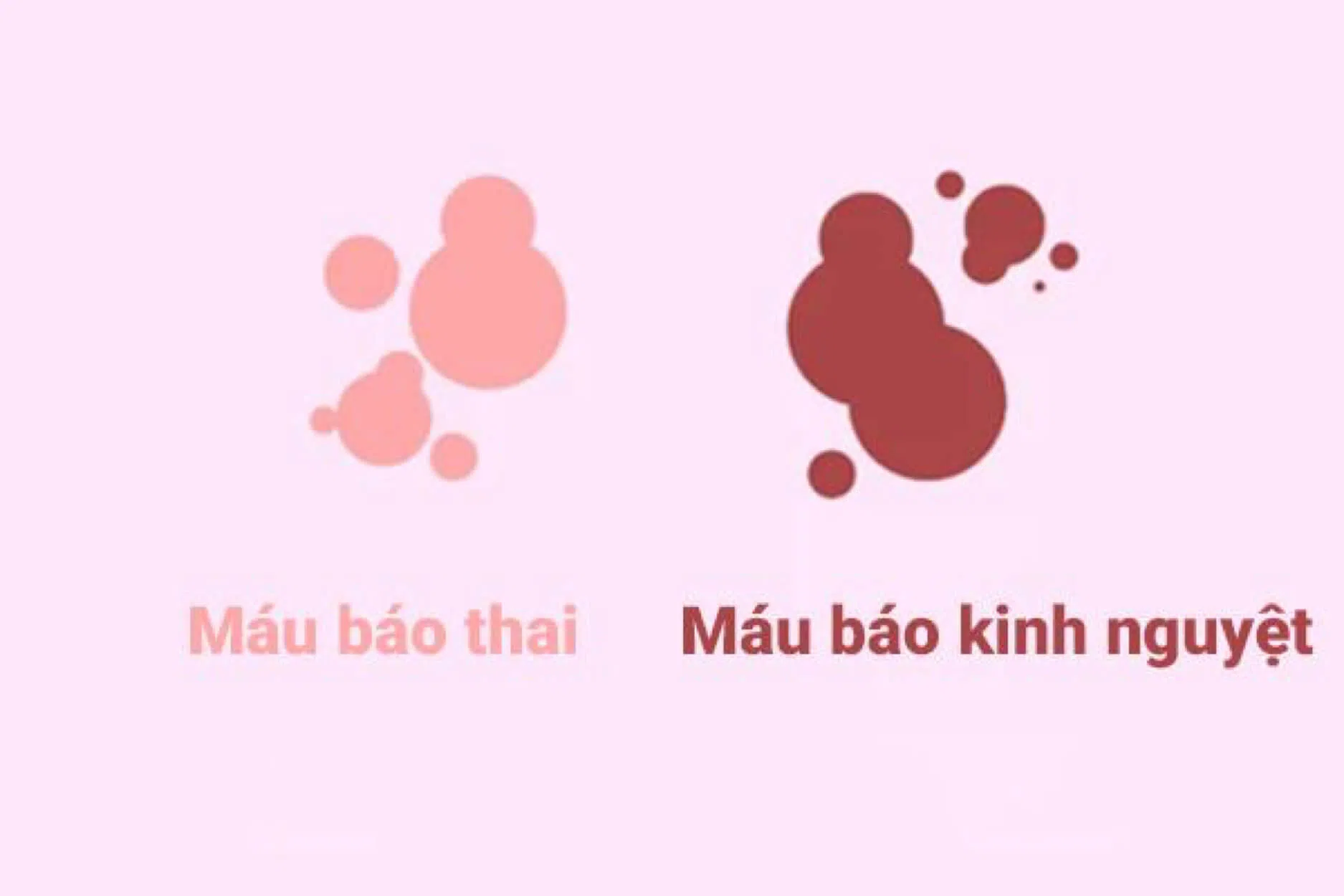 Dựa vào máu báo thai để biết mình có thai hay không?