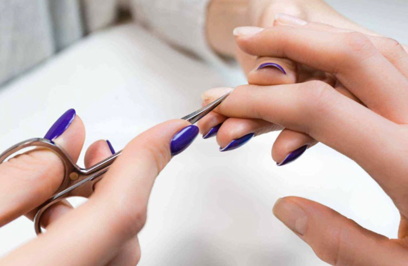 Những nguyên nhân khi làm nail xong bị ngứa cần lưu ý 