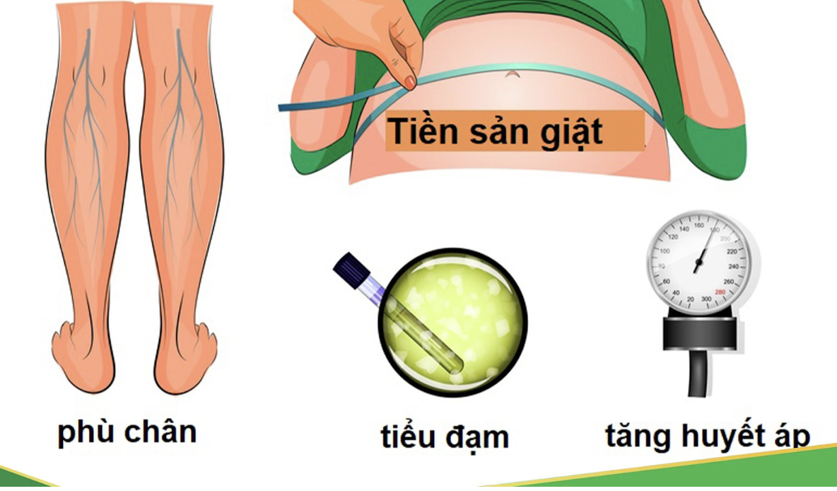 Mẹ bầu có nguy cơ cao tiền sản giật có thể sảy thai trong tam cá nguyệt cuối