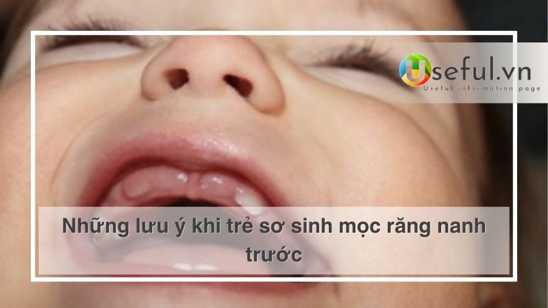 Những lưu ý khi trẻ sơ sinh mọc răng nanh trước