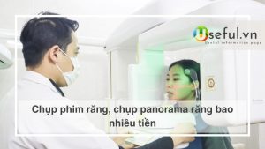 Chụp phim răng, chụp panorama răng bao nhiêu tiền