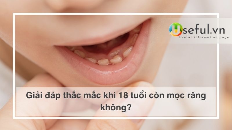 Giải đáp thắc mắc khi 18 tuổi còn mọc răng không?