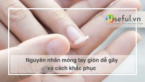 Nguyên nhân móng tay giòn dễ gãy và cách khắc phục