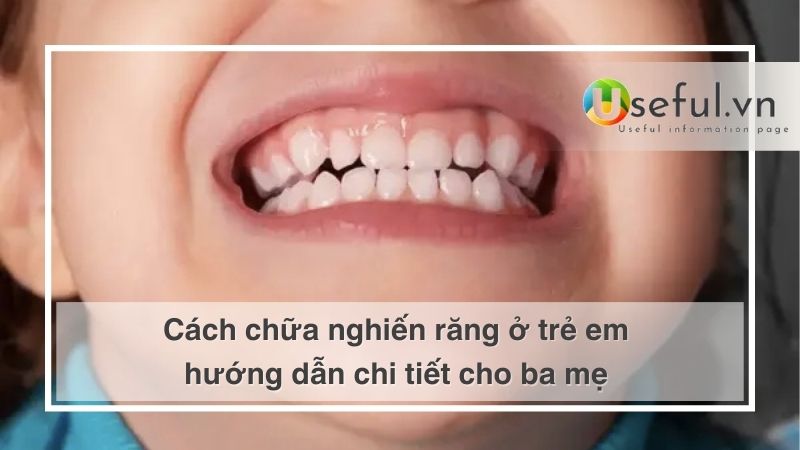 Cách chữa nghiến răng ở trẻ em hướng dẫn chi tiết cho ba mẹ