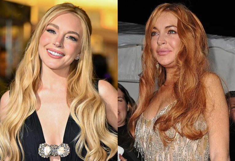 Lindsay Lohan đã "dao kéo" những gì để có diện mạo lột xác như hiện tại? - Ảnh 2.