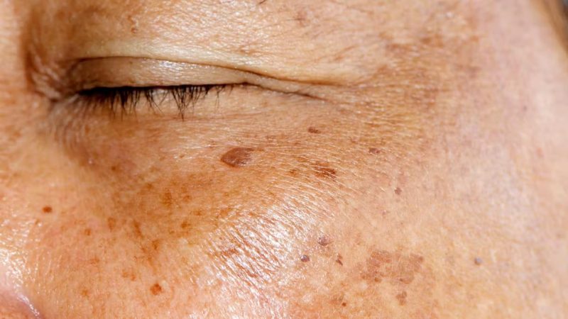 Bí quyết chăm sóc da giúp thu nhỏ lỗ chân lông - Ảnh 2. Bí quyết chăm sóc da giúp thu nhỏ lỗ chân lông - Ảnh 2.