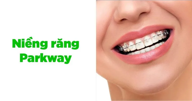 Dịch vụ niềng răng Parkway có tốt không? Giá bao nhiêu? 1 Dịch vụ niềng răng Parkway luôn được khách hàng đánh giá cao