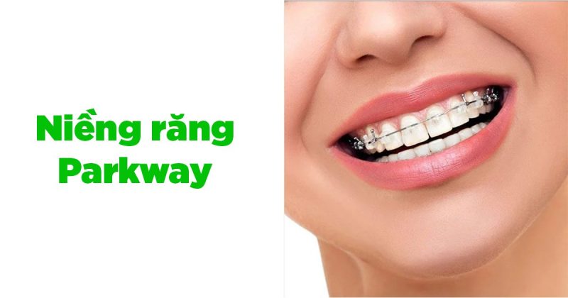 Dịch vụ niềng răng Parkway luôn được khách hàng đánh giá cao