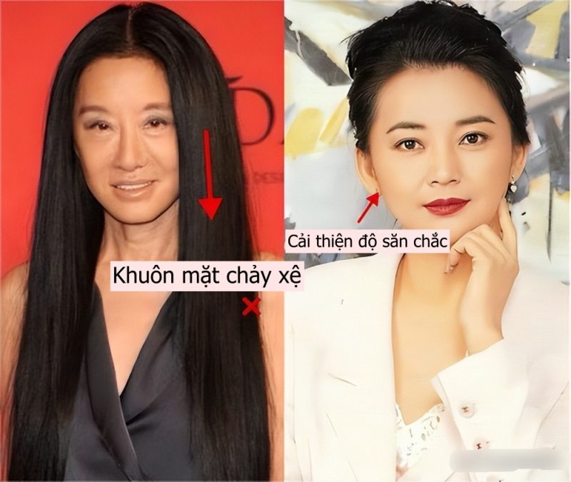 Vì sao phụ nữ trung niên nên cắt tóc ngắn thay vì nhuộm tóc? Nhìn ảnh so sánh bạn sẽ thấy rõ! - Ảnh 3. Vì sao phụ nữ trung niên nên cắt tóc ngắn thay vì nhuộm tóc? Nhìn ảnh so sánh bạn sẽ thấy rõ! - Ảnh 3.