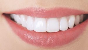 Bảng giá và chi phí làm trắng răng tại nha khoa ParkWay