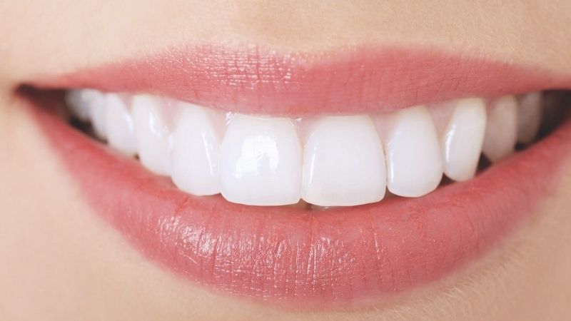 Bảng giá và chi phí làm trắng răng tại nha khoa ParkWay 