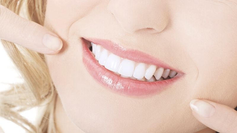 Bảng giá và chi phí làm trắng răng tại nha khoa ParkWay 