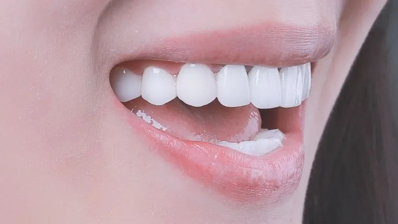Nha khoa thẩm mỹ tẩy trắng răng giá bao nhiêu? Liệu trình trong bao lâu?