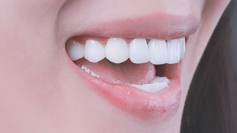 Bảng giá tẩy trắng răng tại nha khoa ParkWay và bảng giá làm răng tại đây 