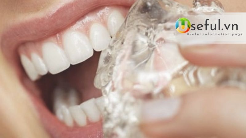 Những mẹo chữa đau răng sâu nhanh nhất