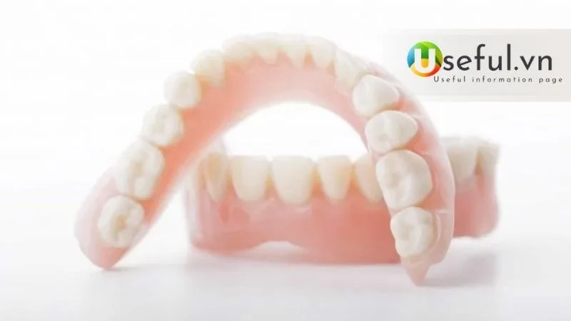 Làm răng giả nên chọn loại nào? Tại sao nên trồng răng Implant 