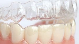 Tại sao phải dùng hàm duy trì? Tác dụng của hàm duy trì là gì?